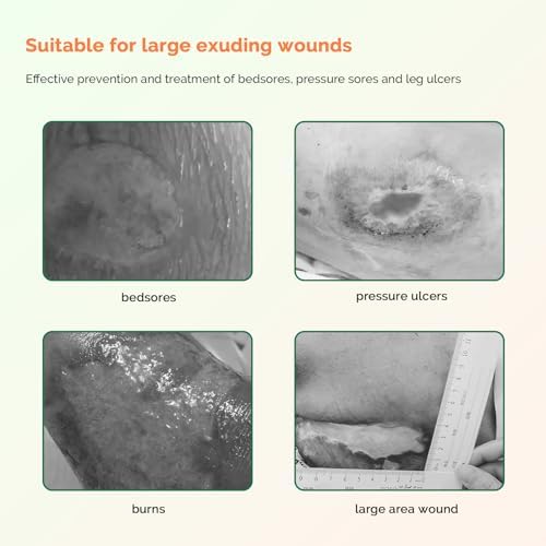 Sacrum Foam Dressing with Border Silicone Adhesive 6"x7" Waterproof