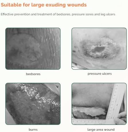 Sacrum Foam Dressing with Border - 10 Packs Silicone Adhesive 7"x7"