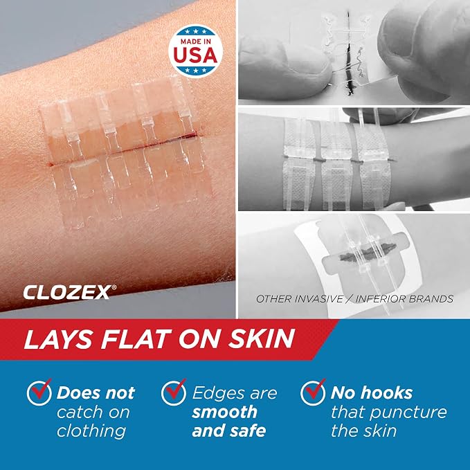 Clozex Emergency Laceration Closures - Image 4